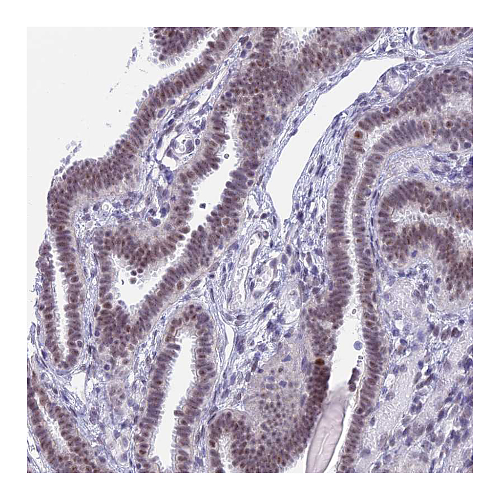 Atlas Antibodies Anti-SRSF5 Antibody