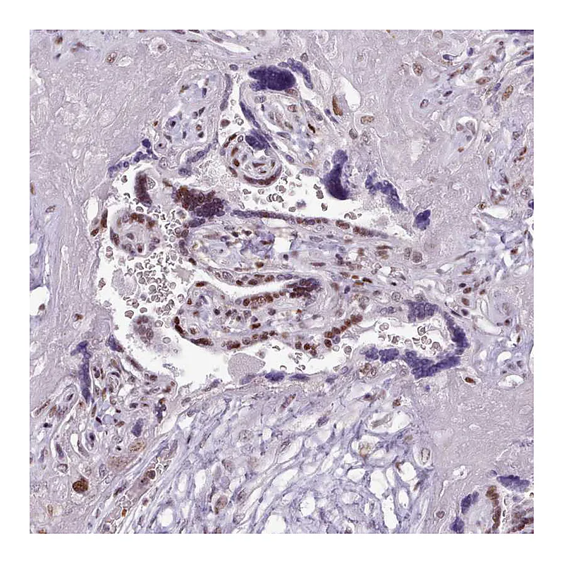 Atlas Antibodies Anti-SRSF4 Antibody