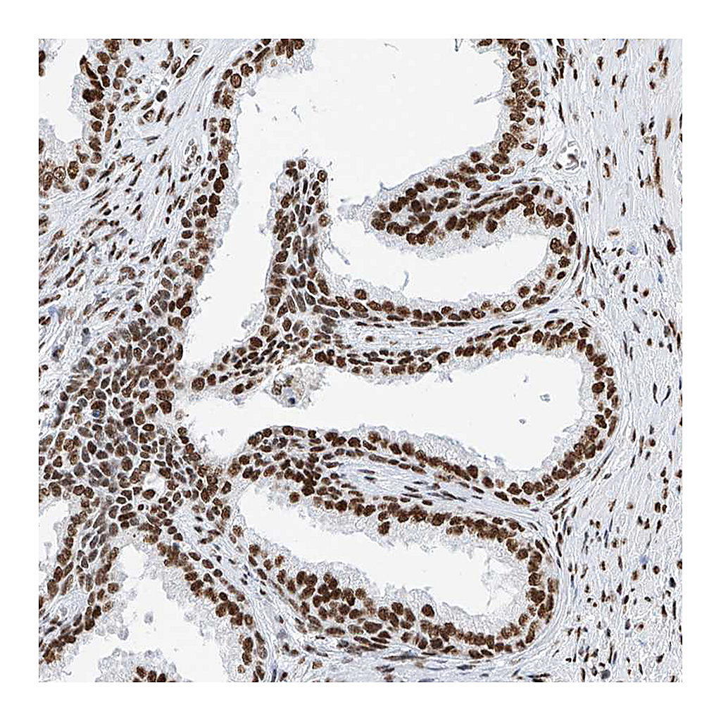 Atlas Antibodies Anti-SRSF6 Antibody