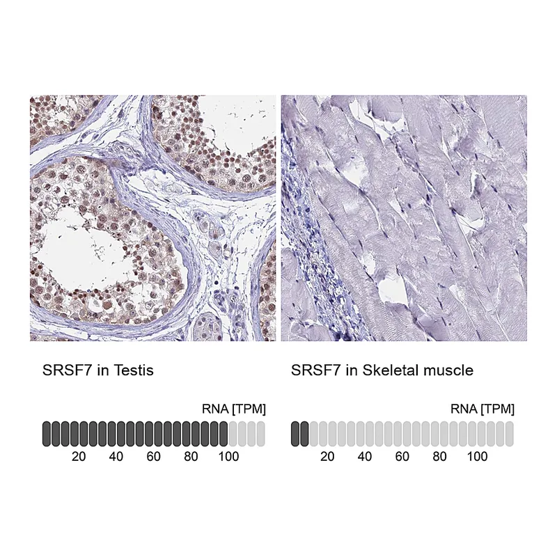 Atlas Antibodies Anti-SRSF7 Antibody