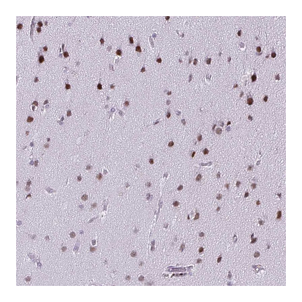 Atlas Antibodies Anti-SS18 Antibody