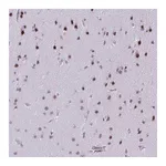 Atlas Antibodies Anti-SS18 Antibody
