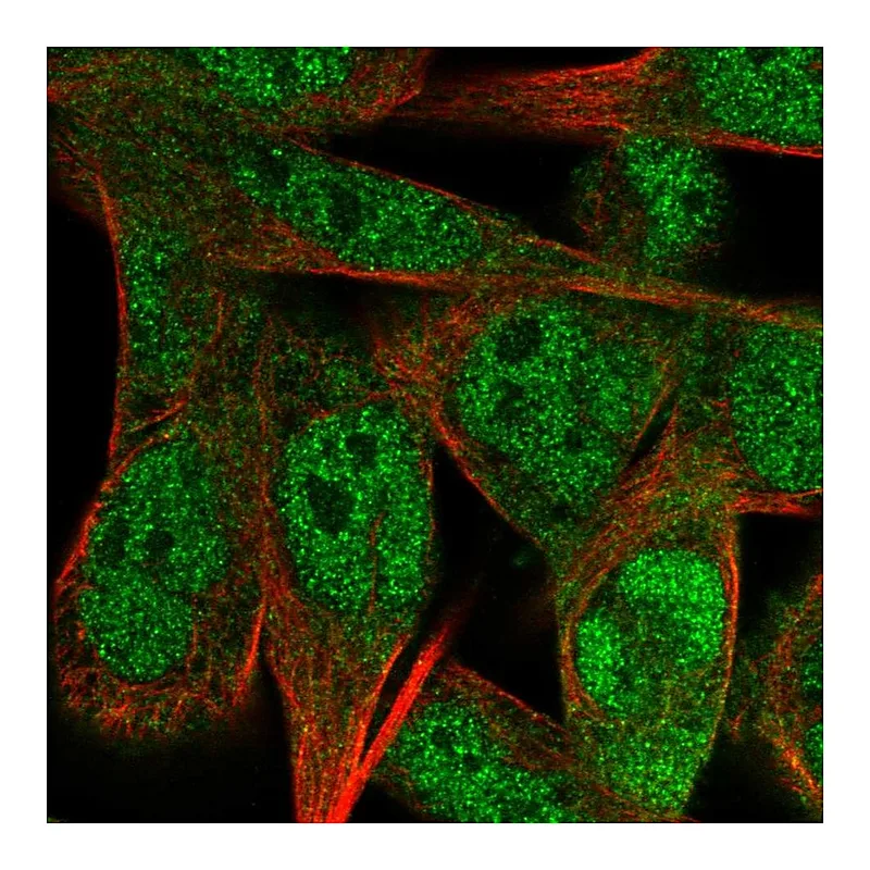 Atlas Antibodies Anti-SS18L1 Antibody