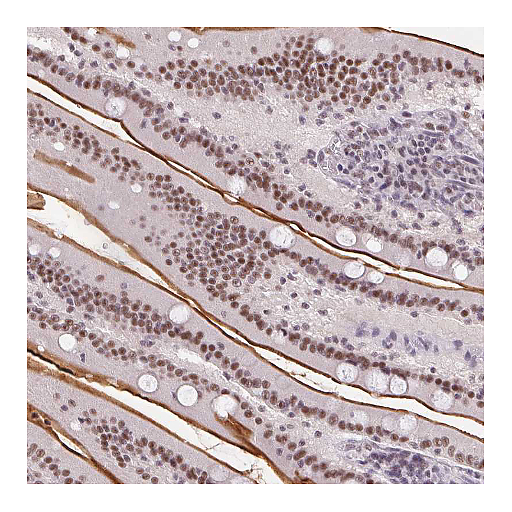 Atlas Antibodies Anti-SRSF7 Antibody