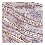 Atlas Antibodies Anti-SRSF7 Antibody