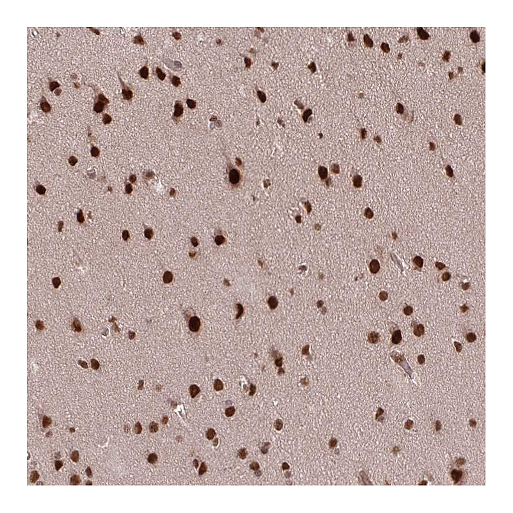 Atlas Antibodies Anti-SS18 Antibody