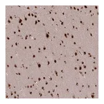 Atlas Antibodies Anti-SS18 Antibody