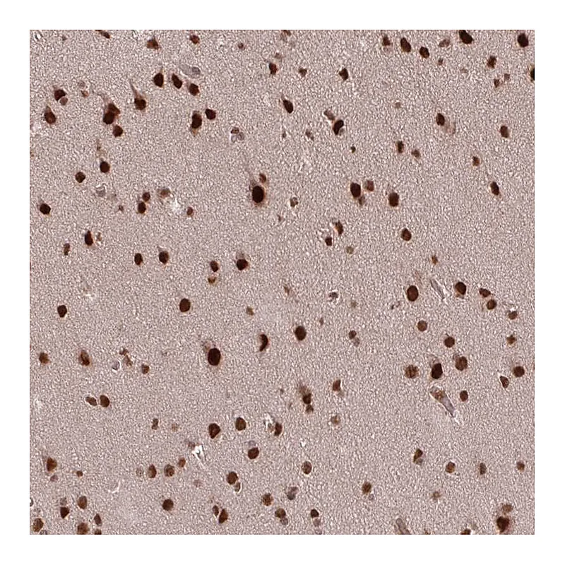 Atlas Antibodies Anti-SS18 Antibody