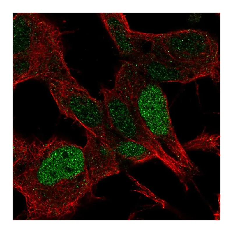 Atlas Antibodies Anti-SSBP2 Antibody
