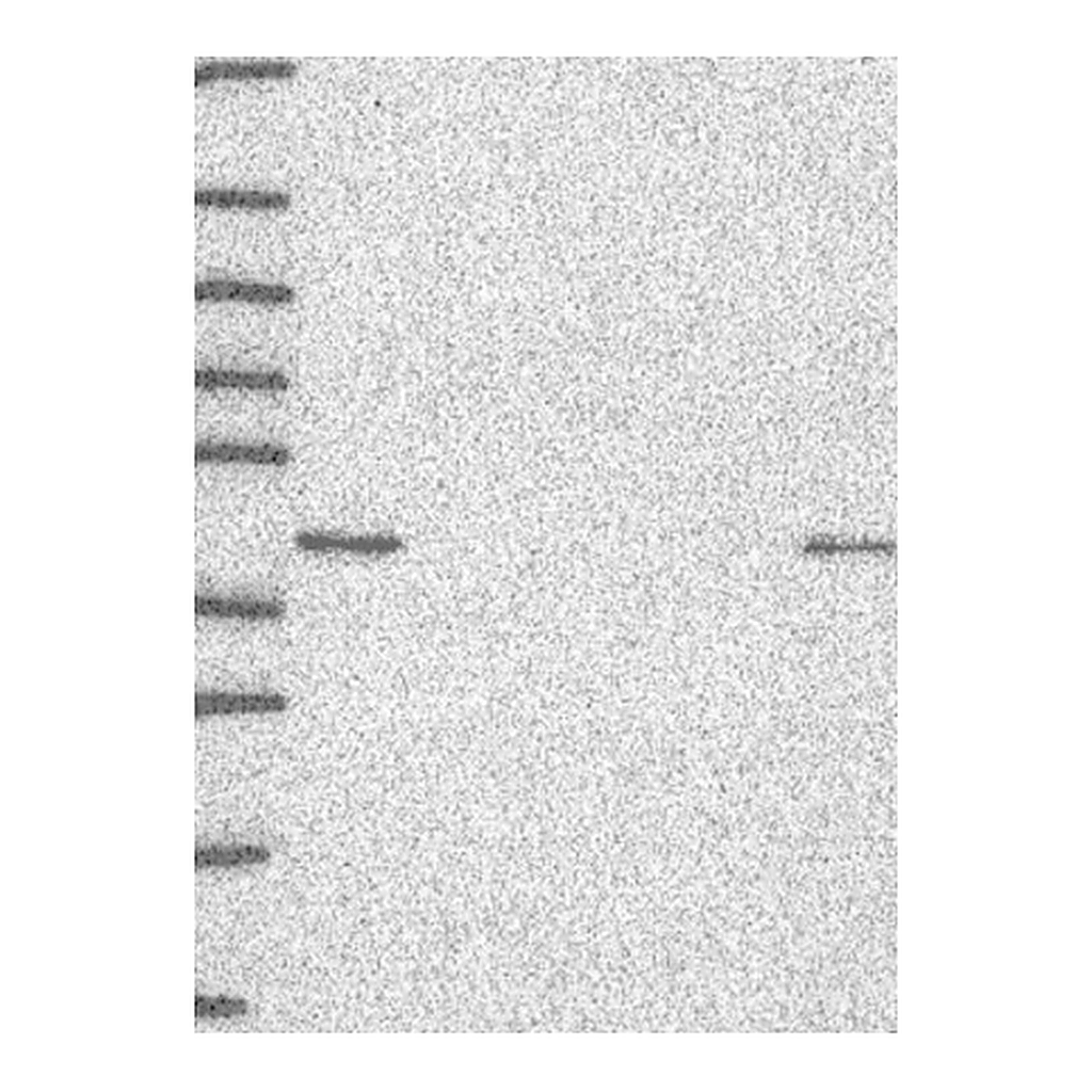 Atlas Antibodies Anti-SSBP2 Antibody