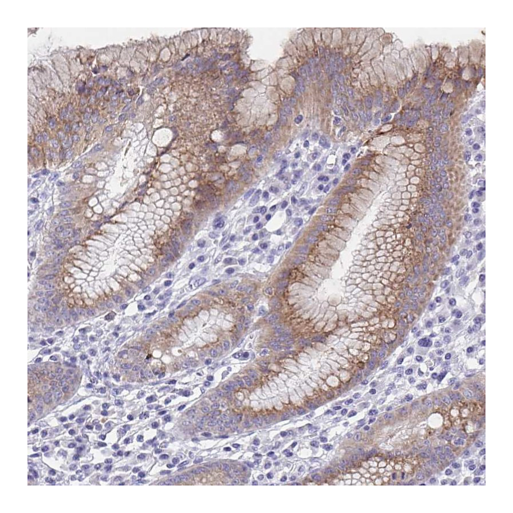 Atlas Antibodies Anti-SSC4D Antibody