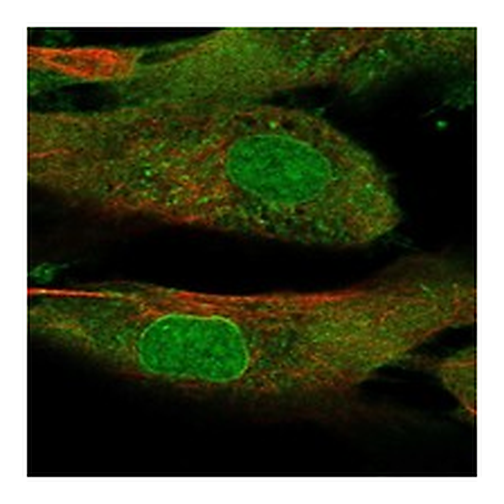 Atlas Antibodies Anti-SSC5D Antibody