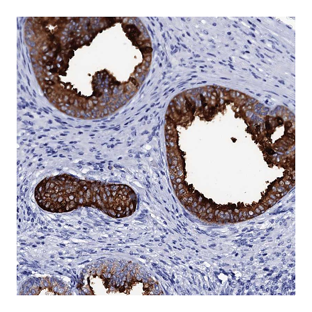 Atlas Antibodies Anti-SSFA2 Antibody