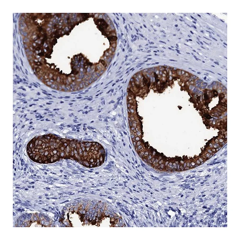 Atlas Antibodies Anti-SSFA2 Antibody