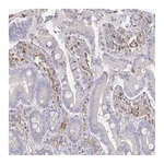 Atlas Antibodies Anti-SSH2 Antibody