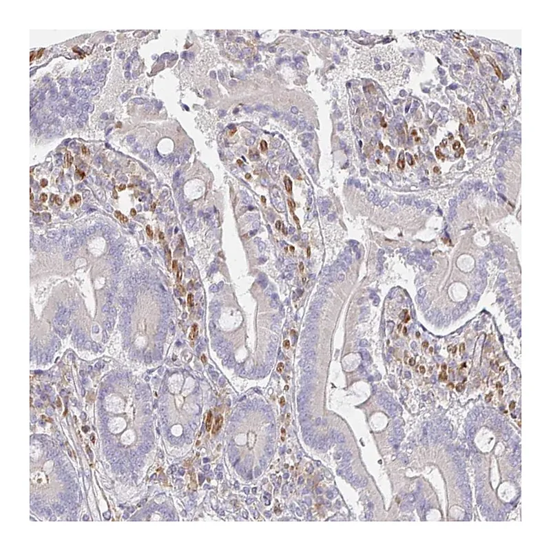 Atlas Antibodies Anti-SSH2 Antibody