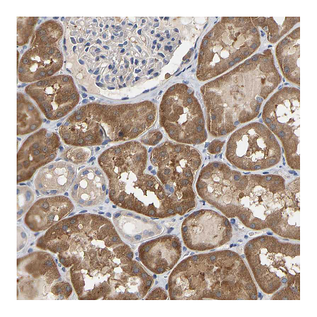 Atlas Antibodies Anti-SSH1 Antibody