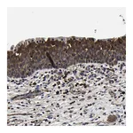 Atlas Antibodies Anti-SSH3 Antibody