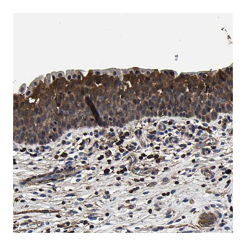 Atlas Antibodies Anti-SSH3 Antibody