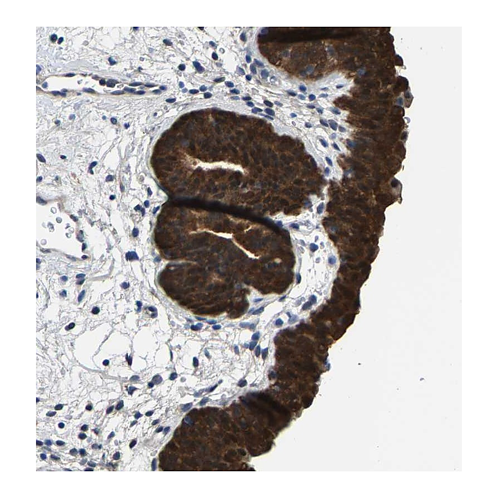 Atlas Antibodies Anti-SSH3 Antibody