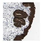 Atlas Antibodies Anti-SSH3 Antibody