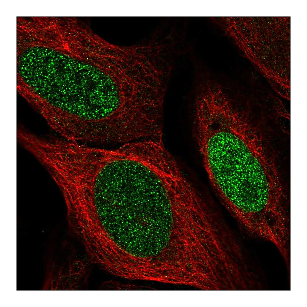 Atlas Antibodies Anti-SSPN Antibody