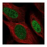 Atlas Antibodies Anti-SSPN Antibody