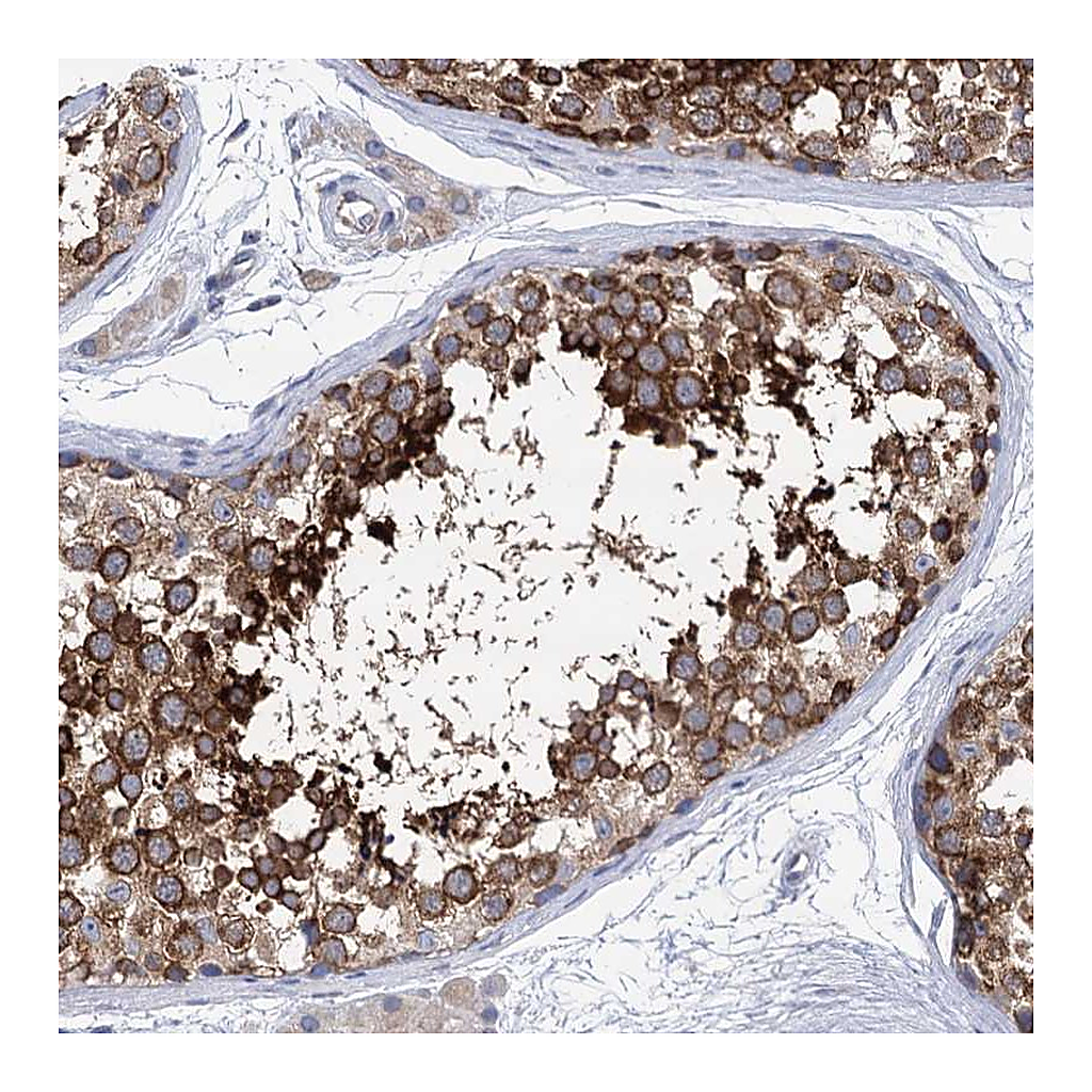 Atlas Antibodies Anti-SSSCA1 Antibody