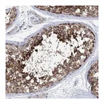 Atlas Antibodies Anti-SSSCA1 Antibody