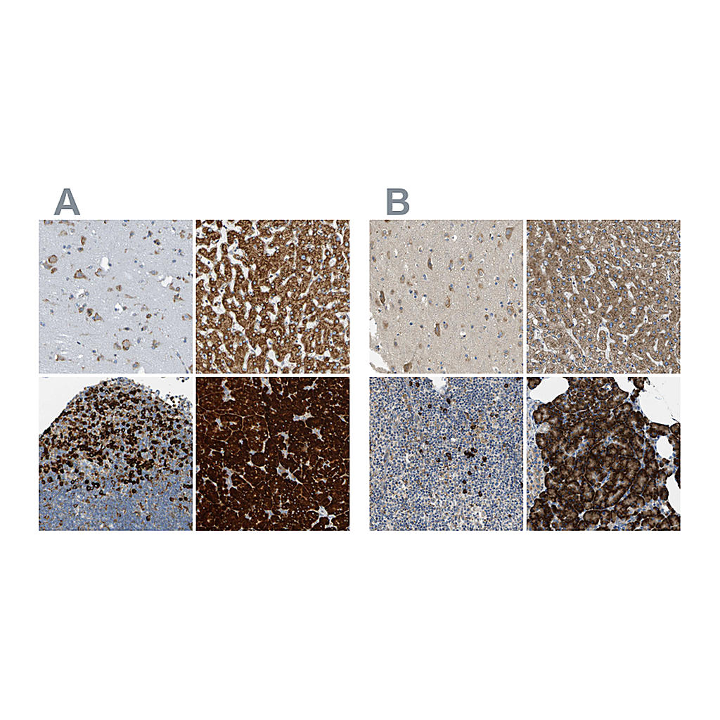 Atlas Antibodies Anti-SSR1 Antibody