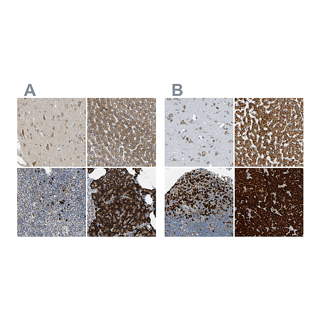 Atlas Antibodies Anti-SSR1 Antibody