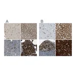 Atlas Antibodies Anti-SSR1 Antibody