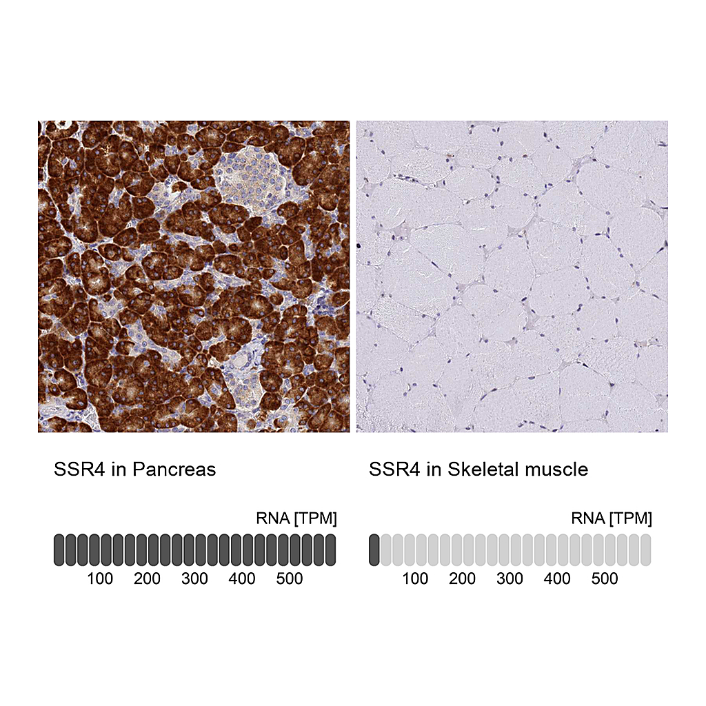 Atlas Antibodies Anti-SSR4 Antibody
