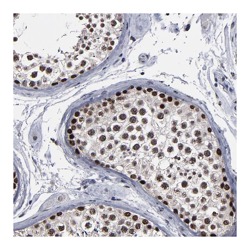 Atlas Antibodies Anti-SSRP1 Antibody