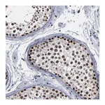 Atlas Antibodies Anti-SSRP1 Antibody