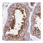 Atlas Antibodies Anti-SSSCA1 Antibody