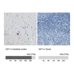 Atlas Antibodies Anti-SST Antibody