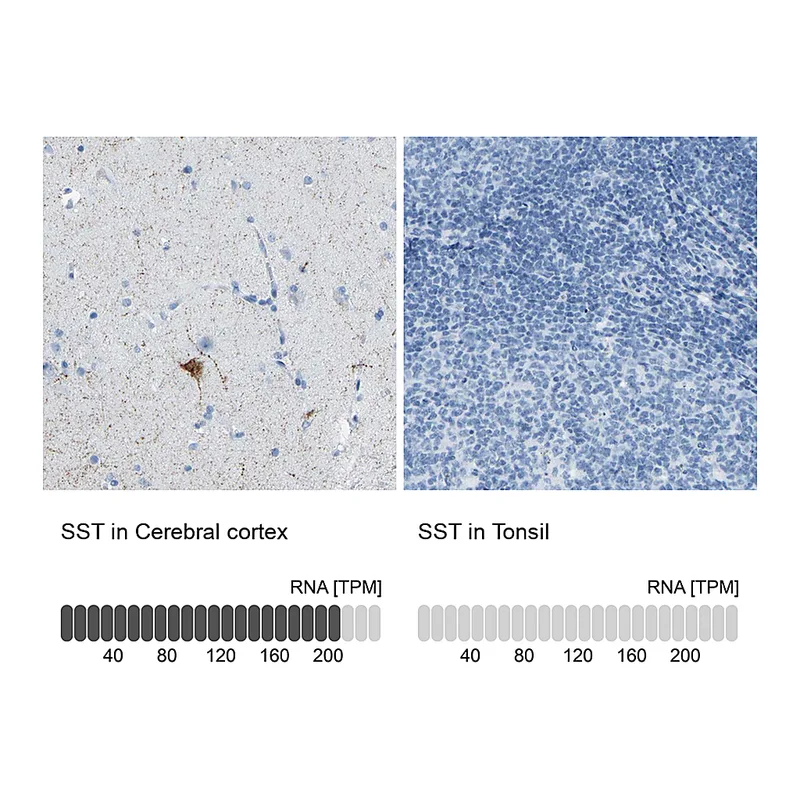 Atlas Antibodies Anti-SST Antibody