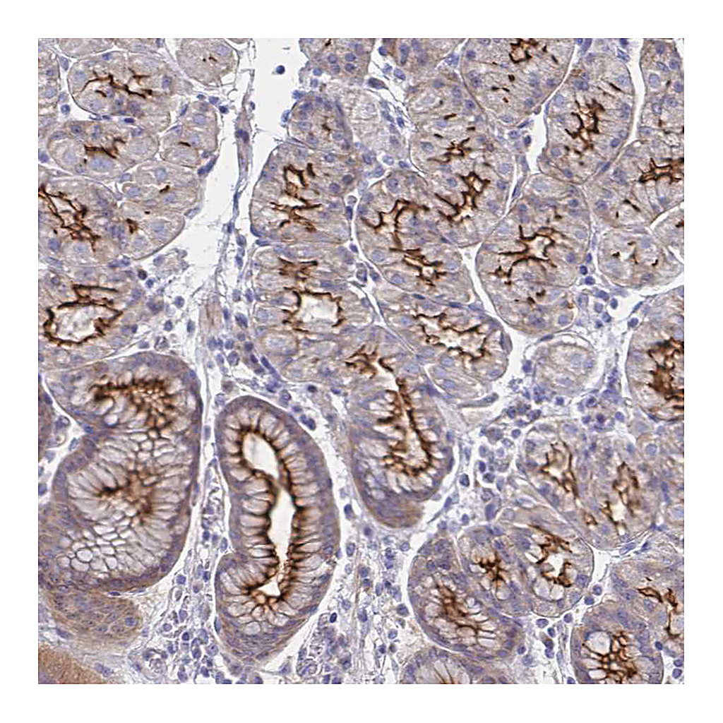Atlas Antibodies Anti-SSTR1 Antibody