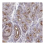 Atlas Antibodies Anti-SSTR1 Antibody