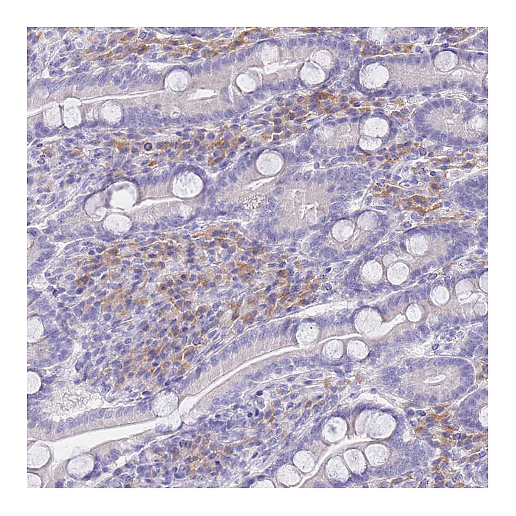 Atlas Antibodies Anti-SSUH2 Antibody