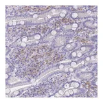 Atlas Antibodies Anti-SSUH2 Antibody