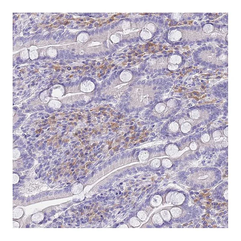 Atlas Antibodies Anti-SSUH2 Antibody