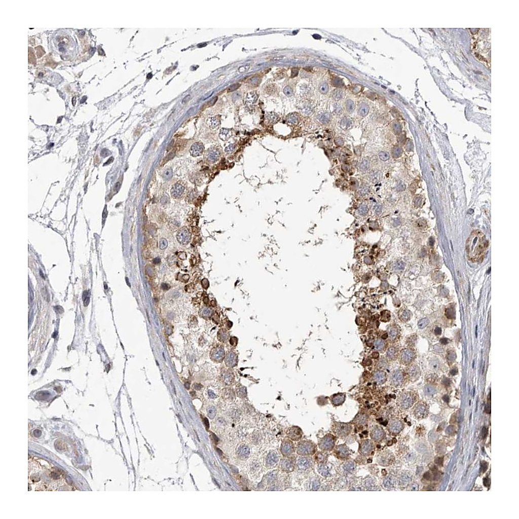 Atlas Antibodies Anti-SSX2IP Antibody