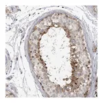 Atlas Antibodies Anti-SSX2IP Antibody