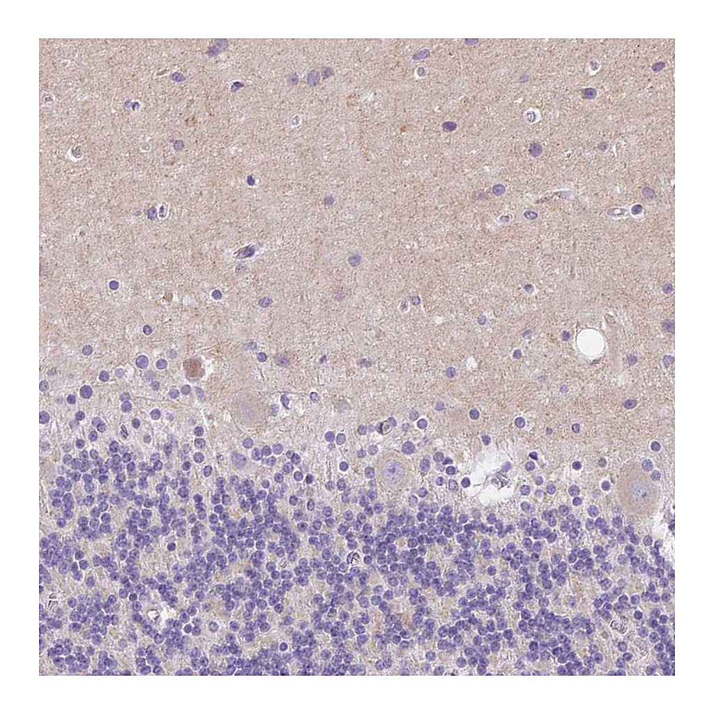 Atlas Antibodies Anti-SSTR4 Antibody