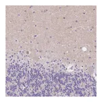Atlas Antibodies Anti-SSTR4 Antibody