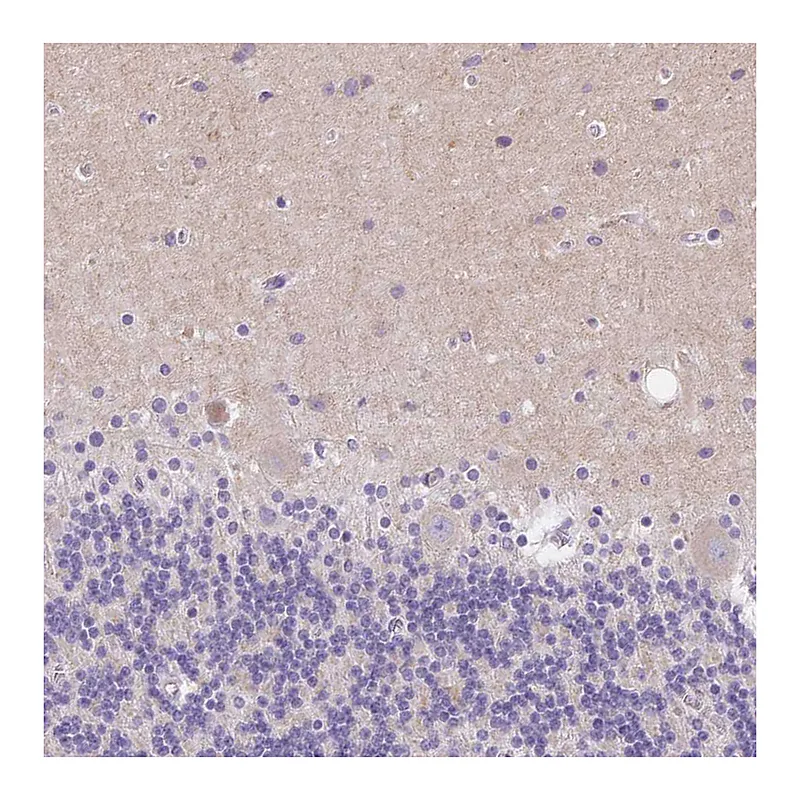 Atlas Antibodies Anti-SSTR4 Antibody