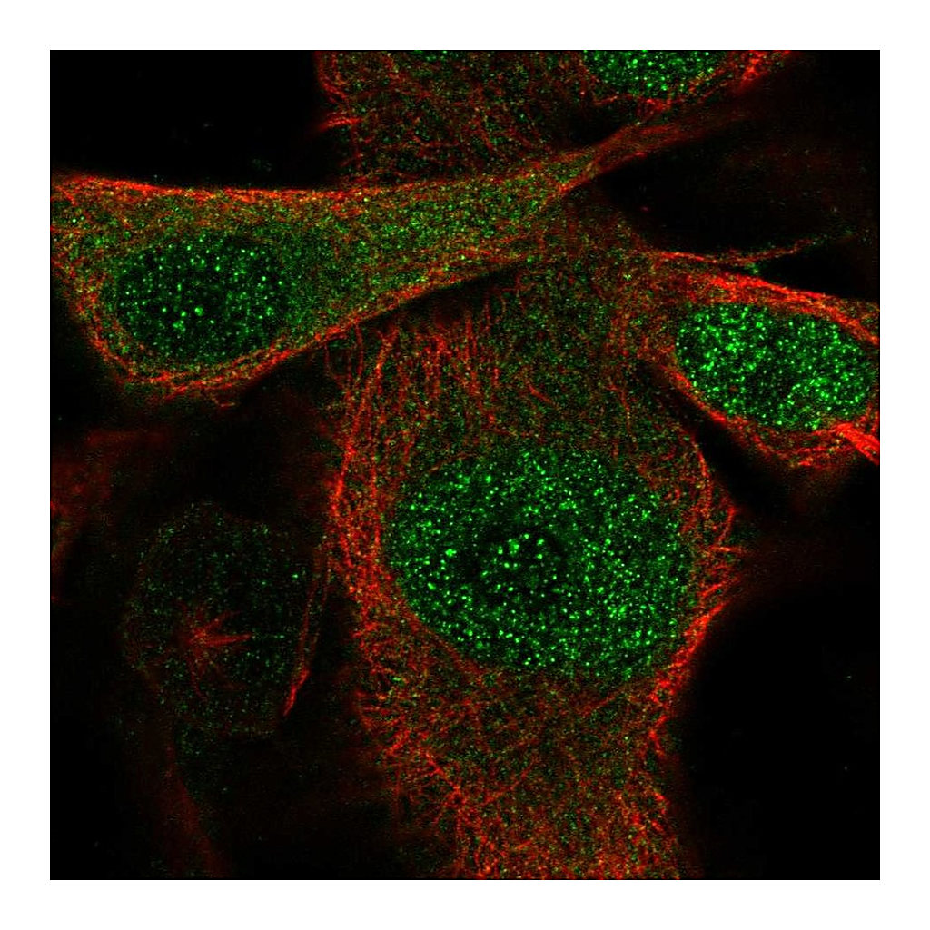 Atlas Antibodies Anti-SSU72 Antibody