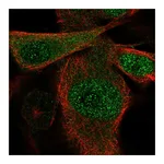 Atlas Antibodies Anti-SSU72 Antibody